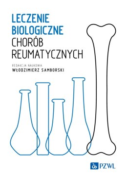 Leczenie biologiczne chorób reumatycznych