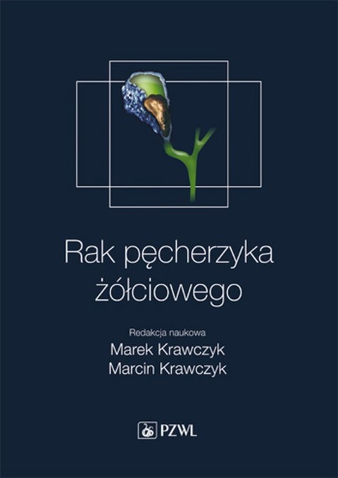 Rak pęcherzyka żółciowego