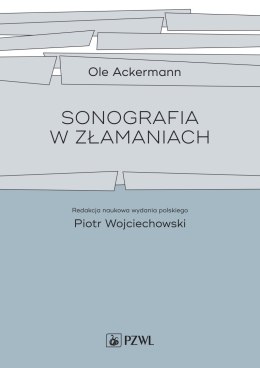 Sonografia w złamaniach